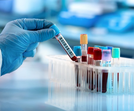 Disease state biospecimen