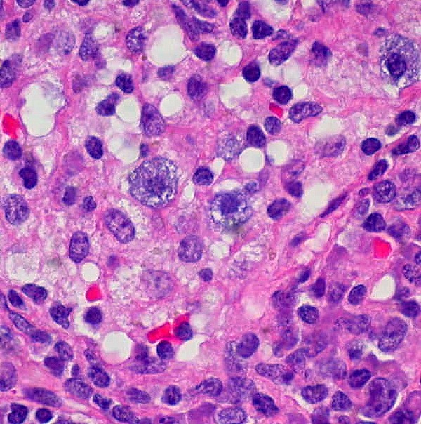 Murine mast cells for research